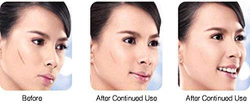 Dermatix Ultra Advanced Scar Formula Gel Reduction Treatment Surgery Keloid 15 g