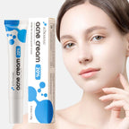 FUIN 20% Azelaic Acid Acne Cream Azelaic Acid Acne Cream For Face Premium,Beauty,Prevents Breakouts, Ease Pimple Clarify Skin Soothe Irritation