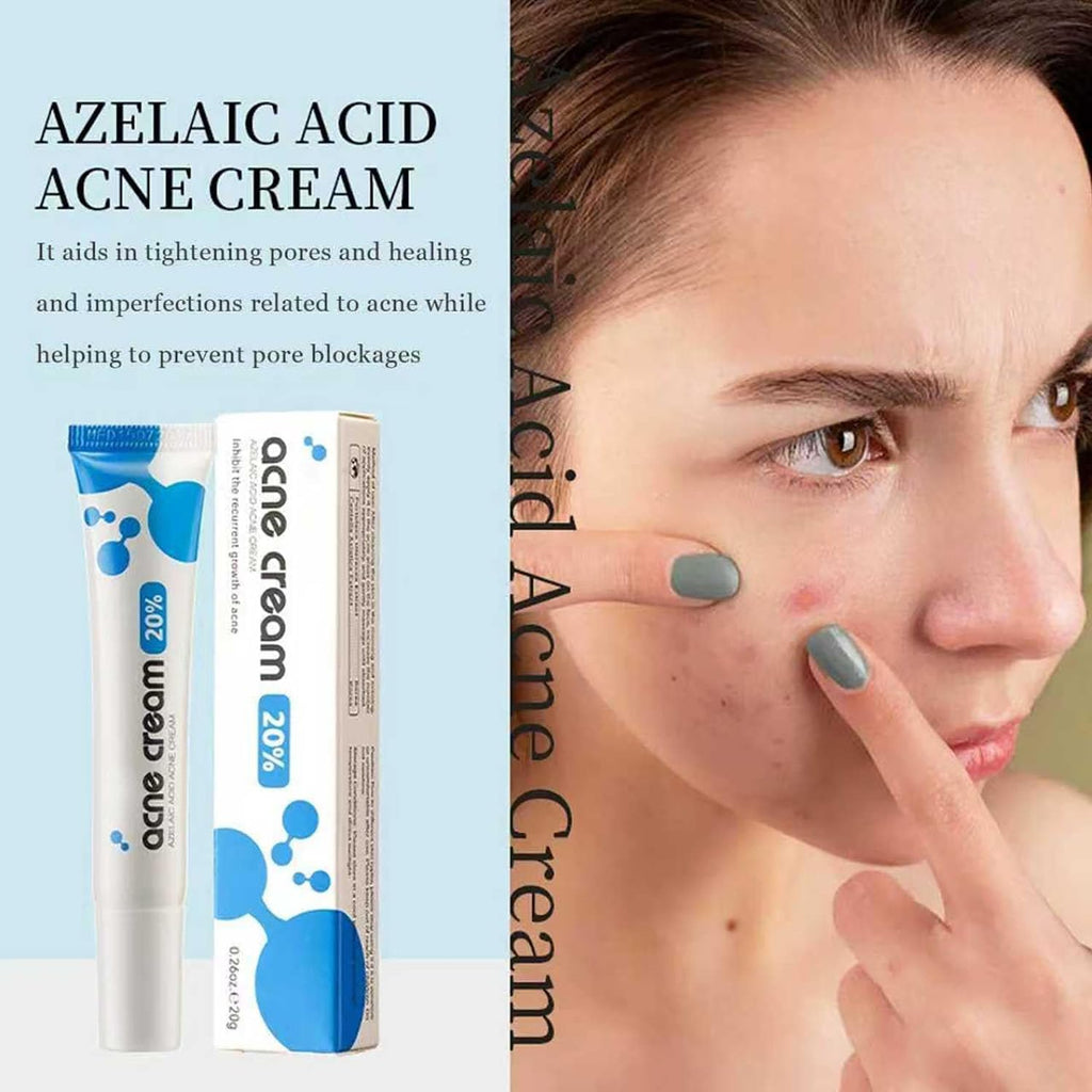 FUIN 20% Azelaic Acid Acne Cream Azelaic Acid Acne Cream For Face Premium,Beauty,Prevents Breakouts, Ease Pimple Clarify Skin Soothe Irritation