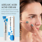 FUIN 20% Azelaic Acid Acne Cream Azelaic Acid Acne Cream For Face Premium,Beauty,Prevents Breakouts, Ease Pimple Clarify Skin Soothe Irritation