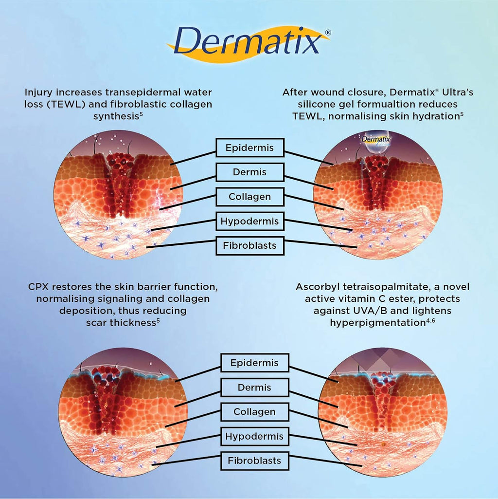 Dermatix Ultra Advanced Scar Formula Gel Reduction Treatment Surgery Keloid 15 g