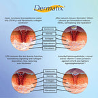 Dermatix Ultra Advanced Scar Formula Gel Reduction Treatment Surgery Keloid 15 g